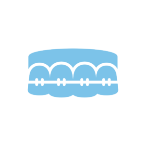 Dental Braces