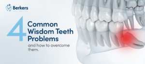 Home 8 4 Common Wisdom Teeth Problems and How to Overcome Them
